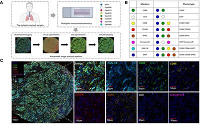 Spatial interaction and functional status of CD68+SHP2+ macrophages in tumor microenvironment correlate with overall survival of NSCLC